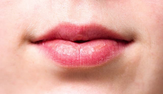 Does drinking coffee make your lips black ?